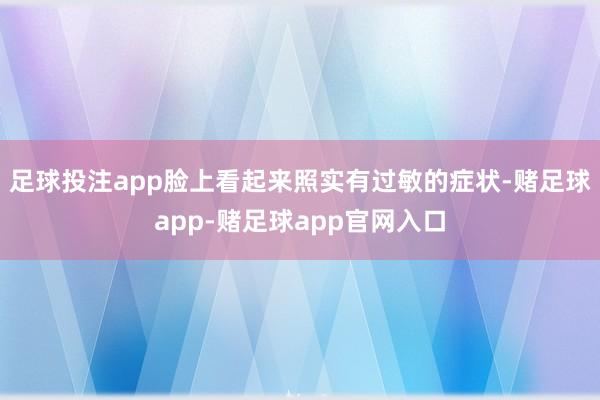 足球投注app脸上看起来照实有过敏的症状-赌足球app-赌足球app官网入口
